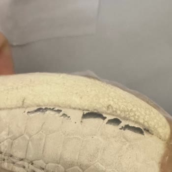 Ofis Ayakkabısındaki Açılma Ve Firma İlgisizliği