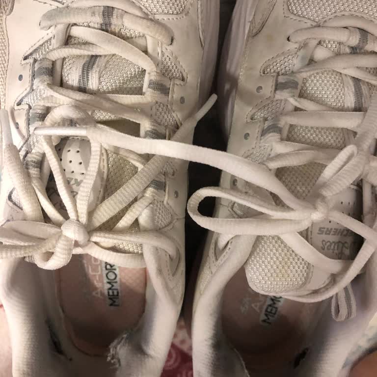 Skechers Ayakkabının Kalitesizliği Ve Müşteri Hizmetleri Sorunu