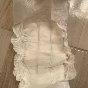 Defolu Bebek Bezleriyle Yaşanan Sorunlar