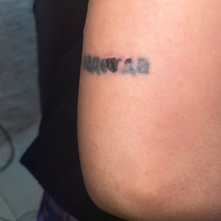 Lazer Seansında Dövme Üzerine Atış Yapıldı, İlgisiz Tavırlar