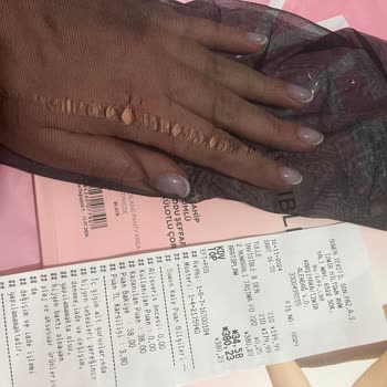 Suwen Çoraplarında Beklenmedik Kalite Sorunu