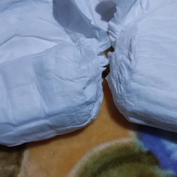 Sleepy Bebek Bezlerinde Kalite Düşüşü Ve Müşteri Hizmetleri Sorunu
