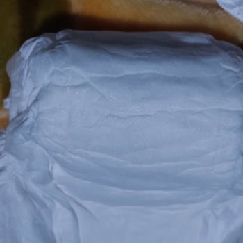 Sleepy Bebek Bezlerinde Kalite Düşüşü Ve Müşteri Hizmetleri Sorunu