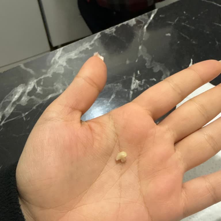 Diş Tedavisinde Sürekli Sorun Yaşadım