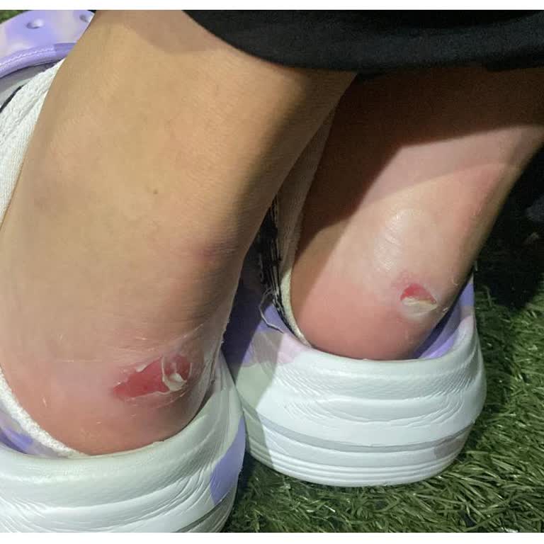 SuperStep'te İade Sürecinde Yaşanan Sorunlar Ve Müşteri Memnuniyetsizliği