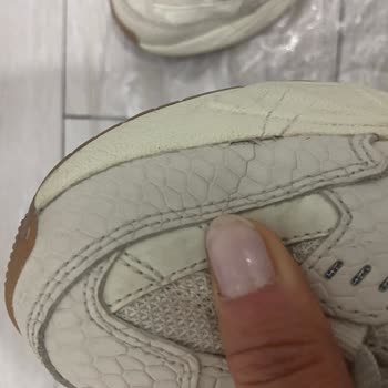 Skechers Ayakkabı Kalite Sorunu Ve Garanti Kapsamı