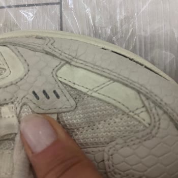 Skechers Ayakkabı Kalite Sorunu Ve Garanti Kapsamı