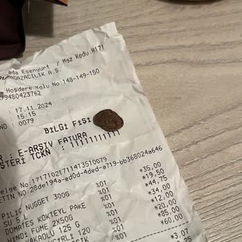 Kuruyemiş Paketinden Çıkan Taş Dişimi Kırıyordu!