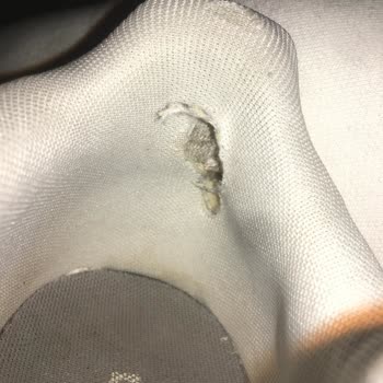 Adidas Ayakkabının Hızla Deformasyonu Ve İade Sorunu