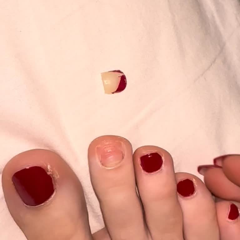 Ayakkabı Tavsiyesi Mağduriyeti: Sağlık Sorunları Ve İlgisizlik