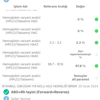 Trendyol'dan Aldığım Sandalyenin Ayağı Kırıldı, Destek Yok