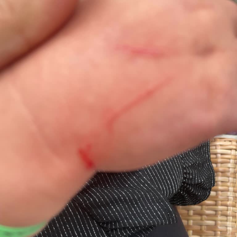 Mukarnas Spa Resort Mini Kulüpte Kedinin Saldırısı Ve Otel İlgisizliği