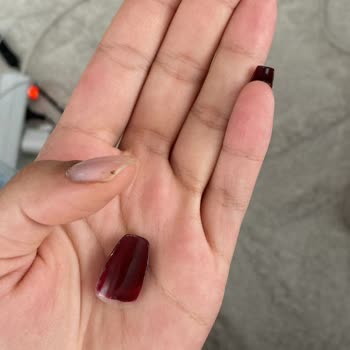 Sürekli Düşen Tırnaklar Ve Yetersiz Telafi Süresi