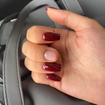 Sürekli Düşen Tırnaklar Ve Yetersiz Telafi Süresi