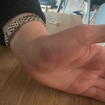 Sahte Ürün Ve İade Sorunu