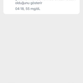 Yanlış Veri Aktarımı Yapan Ölçüm Cihazı