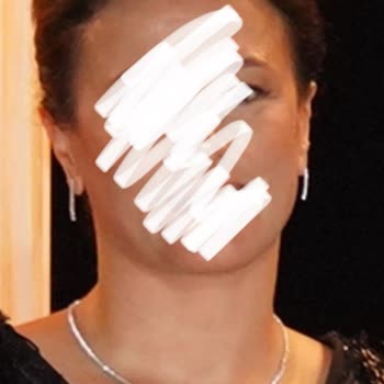 Eki aç