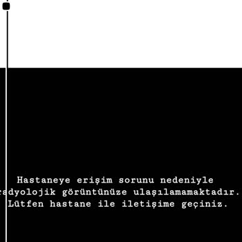 HSG Filminde Görüntü Sorunu Ve Mağduriyet