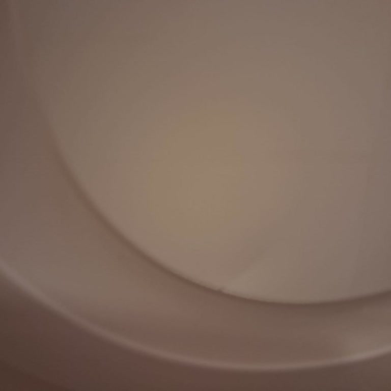 Hasarlı Ürün Teslimatı Ve Kötü Müşteri Hizmeti