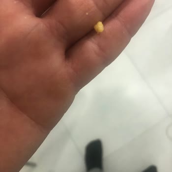 Çerezza Ürününün Hijyen Sorunu