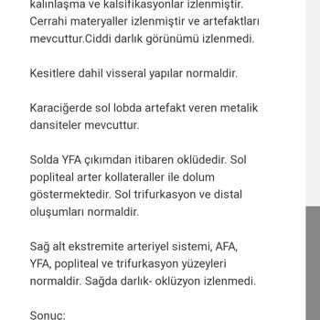 İzmir Katip Çelebi Hastanesi Kalp Damar Cerrahisi Şikayeti