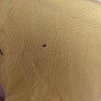 Çamaşır Makinesi Çamaşırları Yırtıyor, Çözüm Bulunamıyor