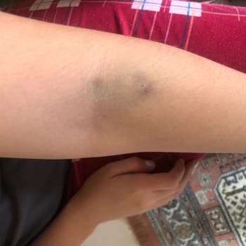 Eskişehir İl Sağlık Müdürlüğü Alanönü Sağlık Ocağı Şikayeti