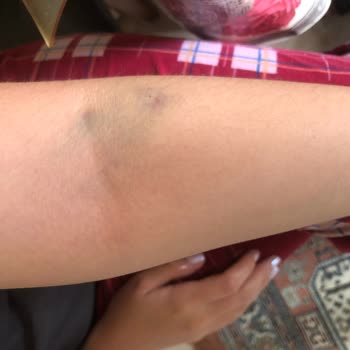 Eskişehir İl Sağlık Müdürlüğü Alanönü Sağlık Ocağı Şikayeti