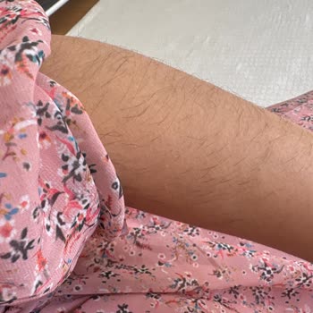 Epilasyon Sonrası Beklenmedik Kıl Artışı