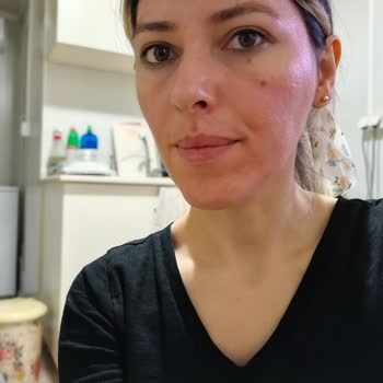 Ciltte Alerji Yapan Krem Hayal Kırıklığı