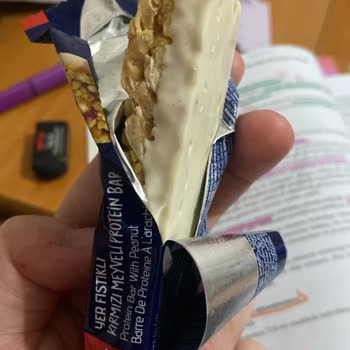 A101 Market'ten Aldığım Üründe Hijyen Sorunu Yaşadım