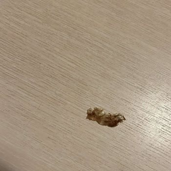 Ülker Çikolatasında Yabancı Madde Şoku