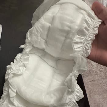 Sleepy Bebek Bezlerinde Kalite Sorunu Ve Hayal Kırıklığı