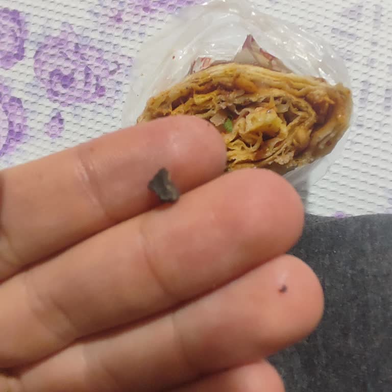 Dönerde Taş Şoku: Dişim Kırılıyordu!