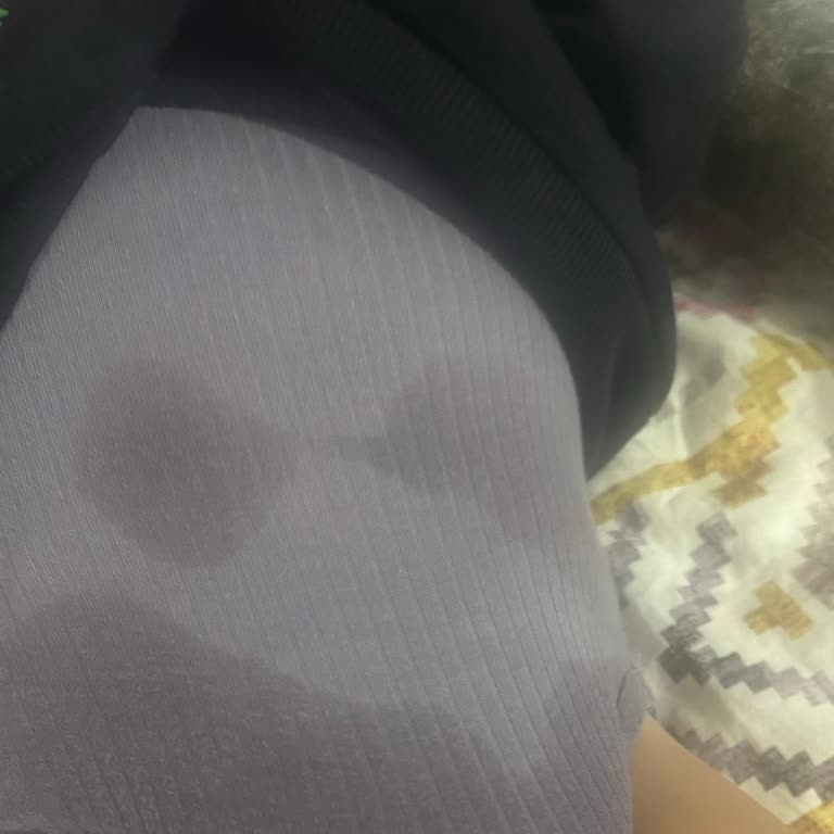Molfix Bebek Bezi Sızıntı Sorunu