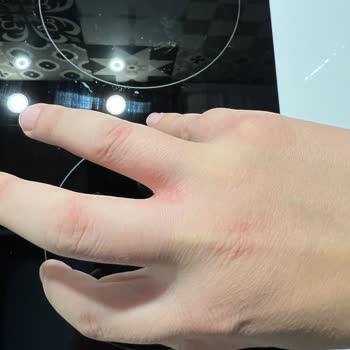 Fairy Limonlu Deterjan: Alerjik Reaksiyon Ve Egzama Sorunu