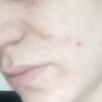 Eki aç