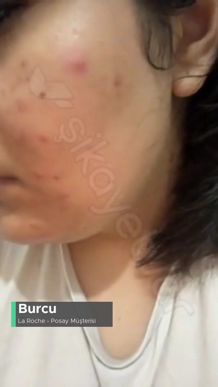 La Roche - Posay Yüz Temizleme Seti Cildimi Mahvetti! videonun kapak resmi