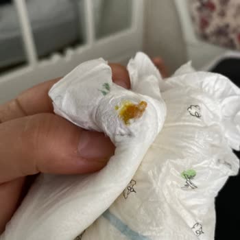 Bebek Bezinde Sert Ve Tehlikeli Madde