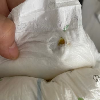 Bebek Bezinde Sert Ve Tehlikeli Madde