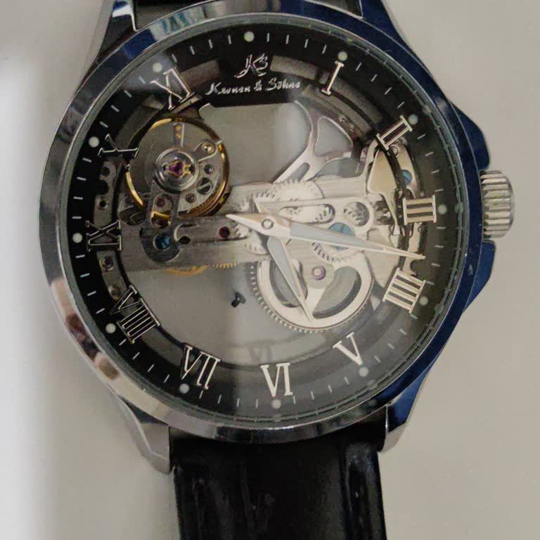 Smart Saat - Saatadam Teknik Servis Sürecinde Hayal Kırıklığı