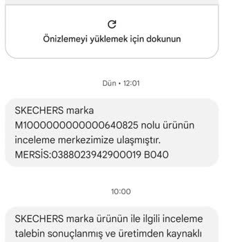 Skechers Ayakkabıda Üretim Kusuru İddiası Ve Mağduriyet