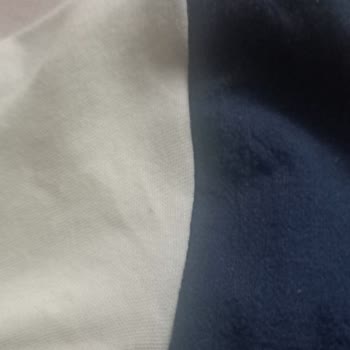 Renk Veren Ürün Ve Yetersiz Müşteri Hizmeti