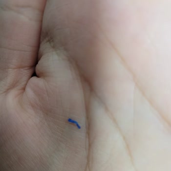 Molped Ped Paketinden Çıkan Sert Parça Şoku