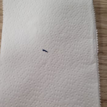 Molped Ped Paketinden Çıkan Sert Parça Şoku
