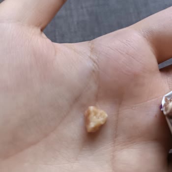 Ülker Piko Çikolatadan Çıkan Taş Şoku