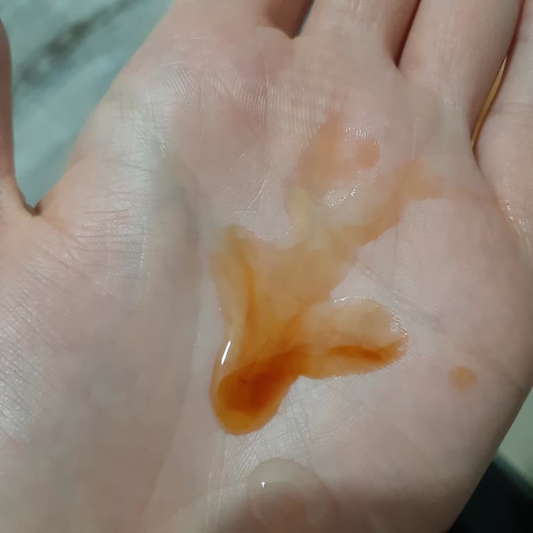 Bozuk C Vitamini Ürünü Sorunu