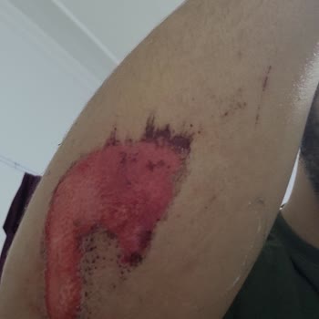 Kırılan Çerçeve: Bisiklet Kazası Ve İletişim Eksikliği