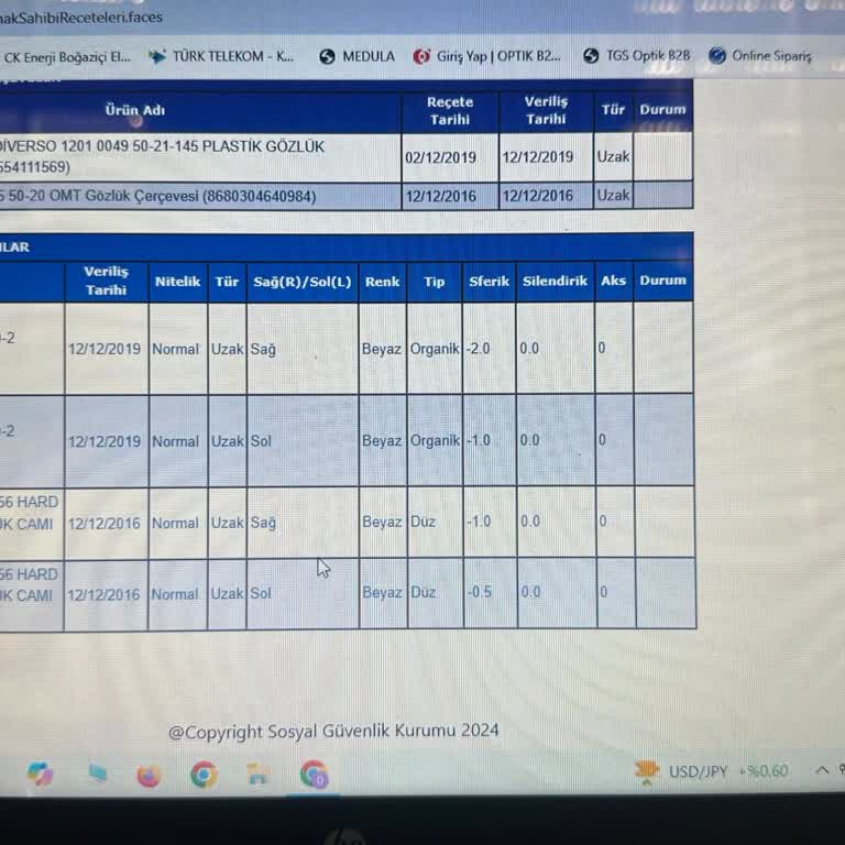 Yanlış Gözlük Numarası Mağduriyeti