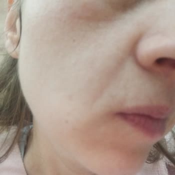 Estee Lauder Rimel Kullanımı Sonrası Göz Problemleri - Şikayetvar